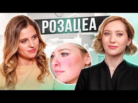 Видео: РОЗАЦЕА | КРАСНЫЕ ЩЁКИ | ПОКРАСНЕНИЯ НА ЛИЦЕ | NEW WAY CLINIC