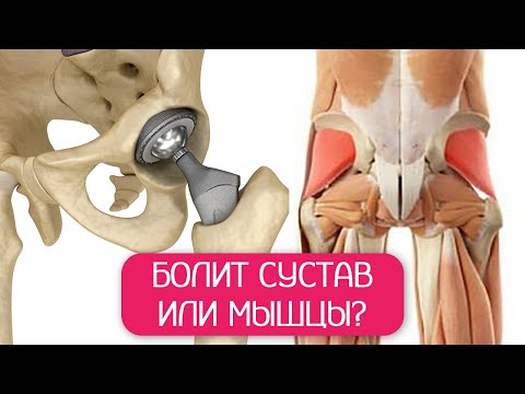 Видео: Всегда ли нужно эндопротезирование суставов?