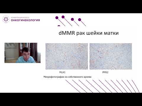 Видео: Определение MSI, PDL-1 статуса, методики выбора