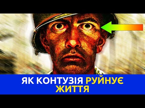 Видео: Що таке КОНТУЗІЯ і її Наслідки. Що може бути з Людиною після КОНТУЗІЇ. Чи лікується КОНТУЗІЯ