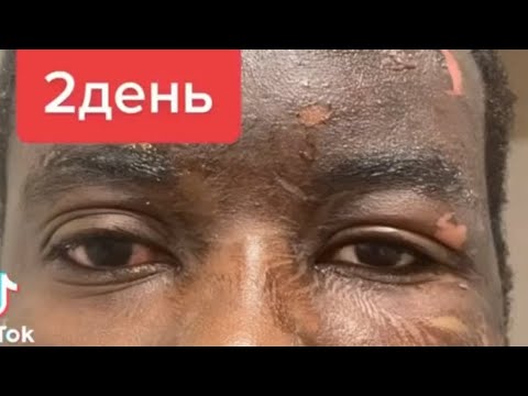Видео: Почему на меня напали