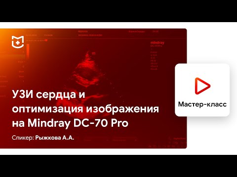 Видео: УЗИ сердца и оптимизация изображения на Mindray DC-70 Pro