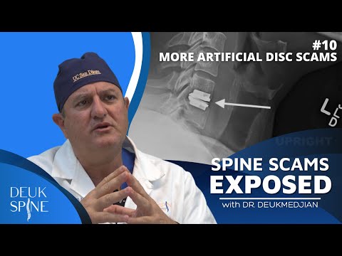 Видео: Ещё больше мошенничеств с искусственными межпозвоночными дисками на Facebook | (Эпизод 10: Разобл...