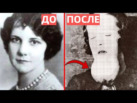 Видео: ОПАСНЫЕ ЗАНЯТИЯ ЛЮДЕЙ 19-20 ВЕКА