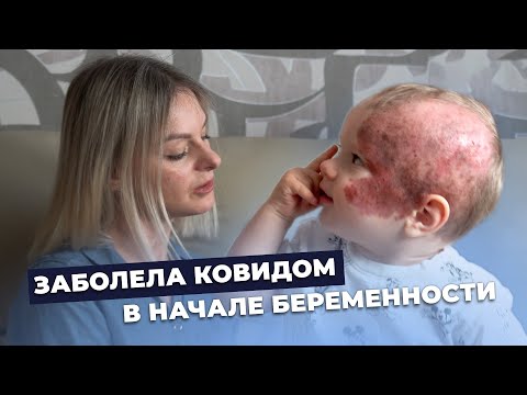 Видео: ГИГАНТСКИЙ НЕВУС | История Димы Чабанюка