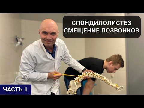 Видео: СМЕЩЕНИЕ ПОЗВОНКОВ.  СПОНДИЛОЛИСТЕЗ (часть 1)