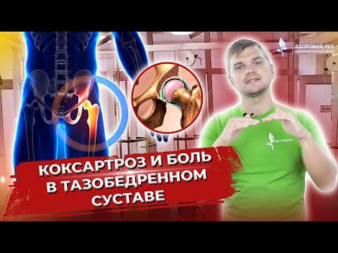 Видео: Коксартроз и боль в тазобедренном суставе.