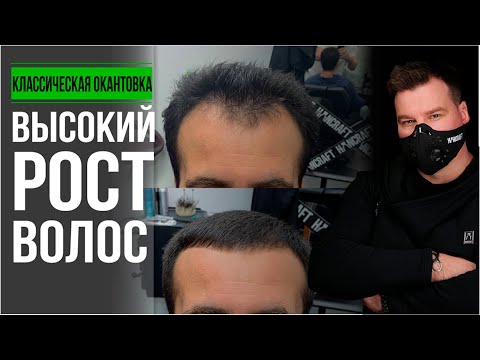 Видео: Как подстричь мужскую Стрижку на средние волосы /by Юрия Жданова /Урок №11/Hancraft.pro