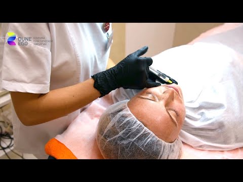 Видео: Один из лучших современных препаратов для биоревитализации Novacutan Новакутан уже в Dune Ego