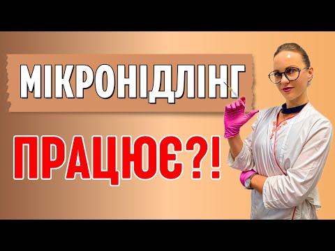 Видео: Мікронідлінг ✨– чи дійсно працює? Ефект, показання, протипоказання