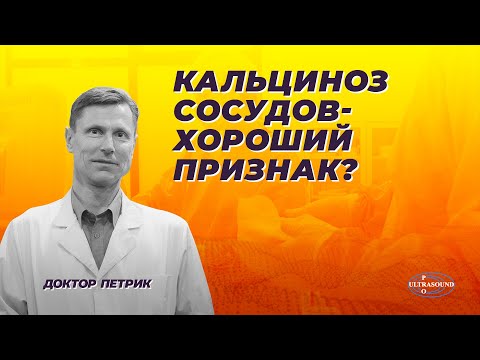 Видео: Кальциноз сосудов - хороший признак?