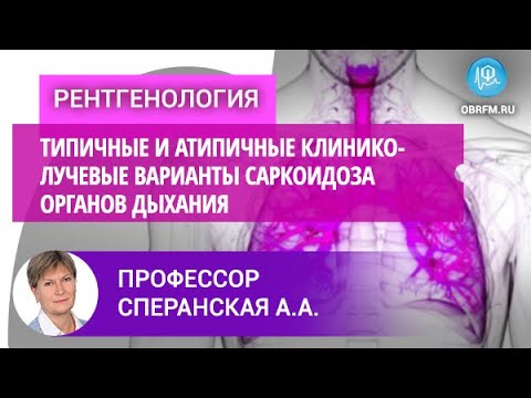 Видео: Профессор Сперанская А.А.: Типичные и атипичные клинико-лучевые варианты саркоидоза органов дыхания
