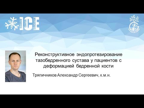 Видео: Реконструктивное эндопротезирование тазобедренного сустава у пациентов с деформацией бедренной кости
