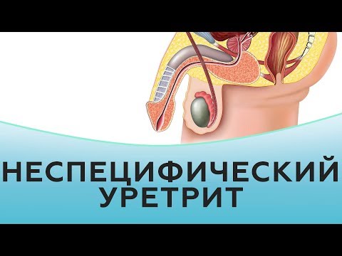 Видео: Неспецифический уретрит у мужчин и женщин