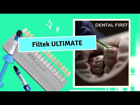 Видео: Универсальная реставрационная система Filtek Ultimate