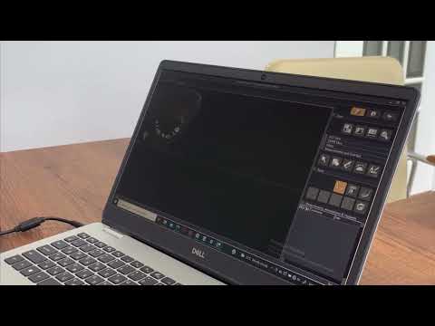 Видео: 3D Dental (i-Dixel) | Инструкция по чтению рентген снимков | Рентген кескіндерін оқу -  нұсқаулық