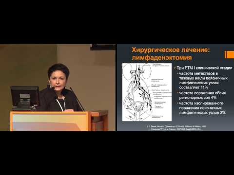 Видео: Хирургическое лечение рака тела матки