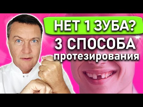 Видео: Как протезировать при отсутствии одного зуба? Нет одного зуба что делать?