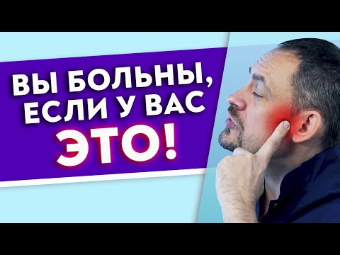 Видео: У 90 % людей кошмарные жевательные мышцы! || Самостоятельная диагностика челюсти и жевательных мышц