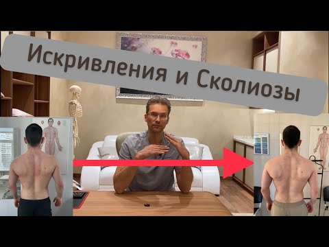 Видео: Как исправить осанку. Лечение сколиоза.