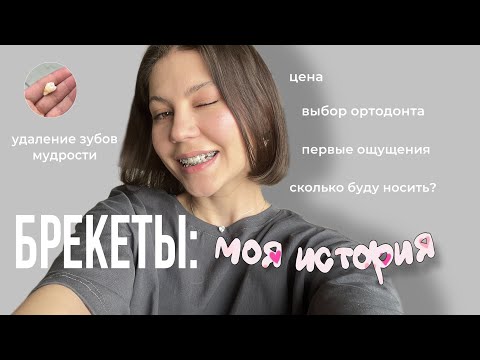 Видео: 5 МЕСЯЦЕВ С БРЕКЕТАМИ🦷адское удаление восьмерок✨опухшая щека✨странный ортодонт🌛