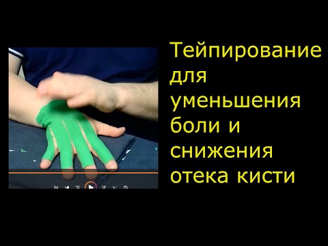Видео: Тейпирование кисти и лучезапястного сустава для облегчения боли, уменьшения отёка и лучшего сгибания