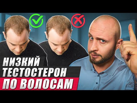 Видео: Связно ли облысение с НИЗКИМ уровнем тестостерона? / Что нам может сказать состояние наших волос?