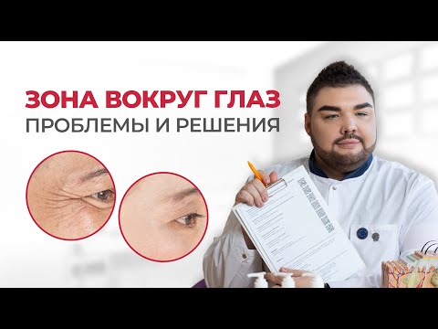 Видео: УХОД за зоной вокруг глаз: процедуры + рекомендации косметолога