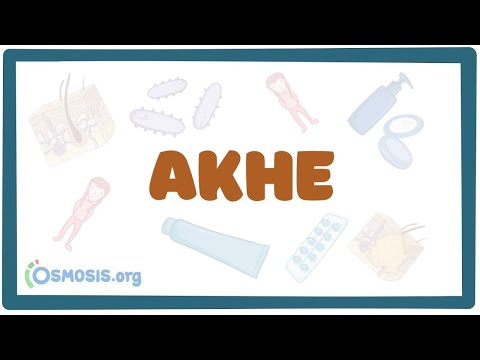 Видео: Акне - лечение, причины (дерматология) лекция