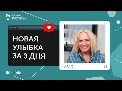 Видео: Базальная имплантация спасла ситуацию и вернула здоровую улыбку | Отзыв спустя три года