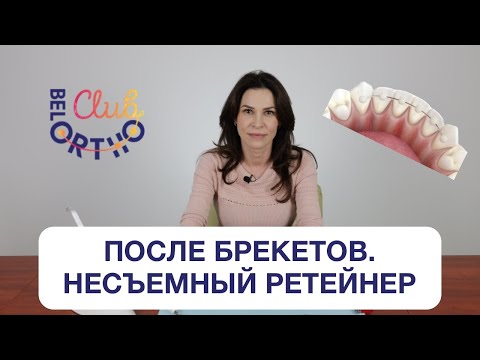 Видео: После брекетов. Несъемный ретейнер | БелОртоКлуб