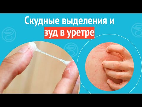 Видео: 👉 Скудные выделения и зуд в уретре. Клинический случай №1255
