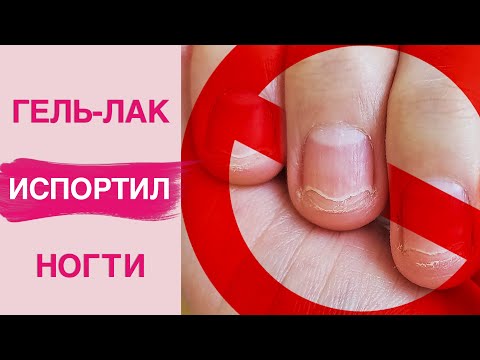 Видео: Чем опасен гель лак? Аллергия, ожог, онихолизис