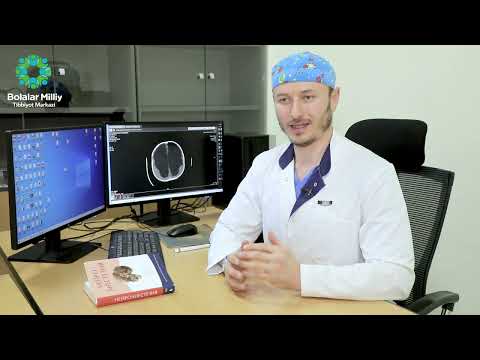 Видео: Гидроцефалия нима?