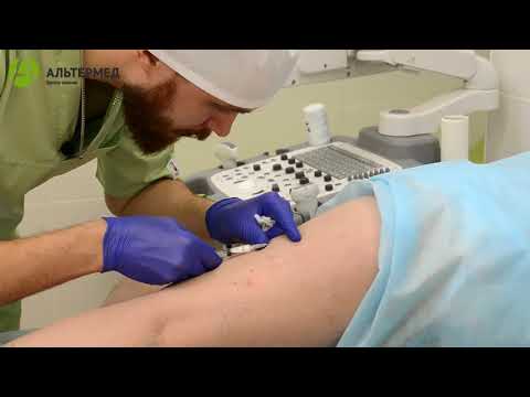 Видео: Компрессионная микросклеротерапия