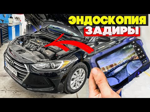 Видео: Hyundai Elantra 2.0 USA - ТВОЮ Ж.. проблема ХУЖЕ ЗАДИРЫ в ЦИЛИНТРАХ! Эндоскопия двигателя ПОКАЗАЛА..