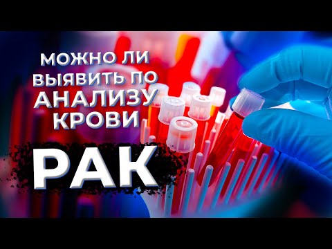 Видео: Анализ крови на РАК #рак #анализы#онкология #диагностика#здоровье #онколог