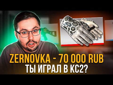 Видео: КЕЙС В КС2 ОПРЕДЕЛИТ РАЗМЕР ДОНАТА - ЗМЕИНЫЙ УКУС