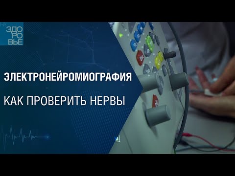Видео: Электронейромиография. Как проверить нервы. На здоровье 16.07.2022
