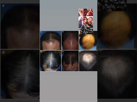 Видео: Трихология часть 2