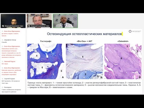 Видео: Костная пластика ген-активированным материалом: методика и долгосрочные результаты