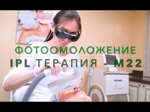 Видео: ФОТООМОЛОЖЕНИЕ IPL   на М22 Lumenis - удаление сосудов, пигментаций, веснушек, возрастных пятен
