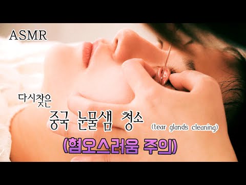Видео: Изумительная очистка китайских глаз - несколько отвратительная - от изумительных слез.Eye Cleaning 