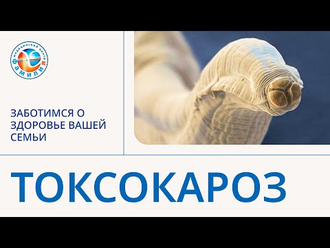 Видео: 👀 Токсокароз