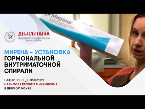 Видео: МИРЕНА - УСТАНОВКА внутриматочной гормональной спирали