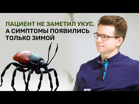 Видео: Болезнь Лайма: Что скрывается за укусом клеща?