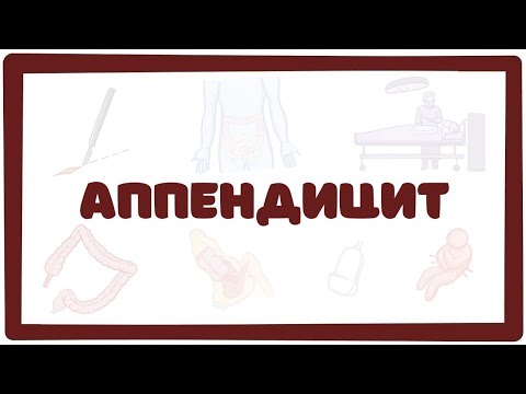 Видео: Аппендицит - причины, симптомы, лечение (хирургия лекция)