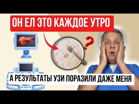 Видео: Он ел сало каждое утро, результаты УЗИ поразили даже меня.Оно спасает печень, помогает желчному.
