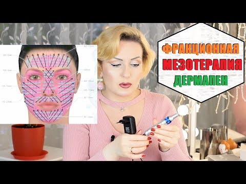 Видео: ФРАКЦИОННАЯ МЕЗОТЕРАПИЯ//ДЕРМАПЕН В ДОМАШНИХ УСЛОВИЯХ//Есть ли эффект?