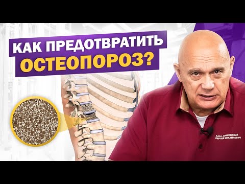 Видео: Профилактика остеопороза: как сохранить крепость костей после 50 лет?